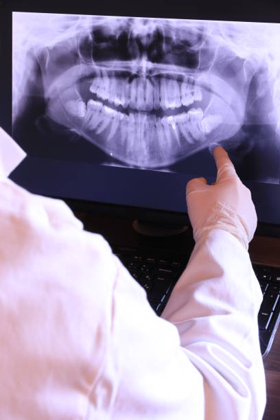 Best Chipped Tooth Repair Near Me  in Cologne, MN